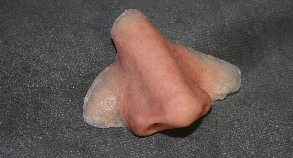Photo of a prosthetics nose